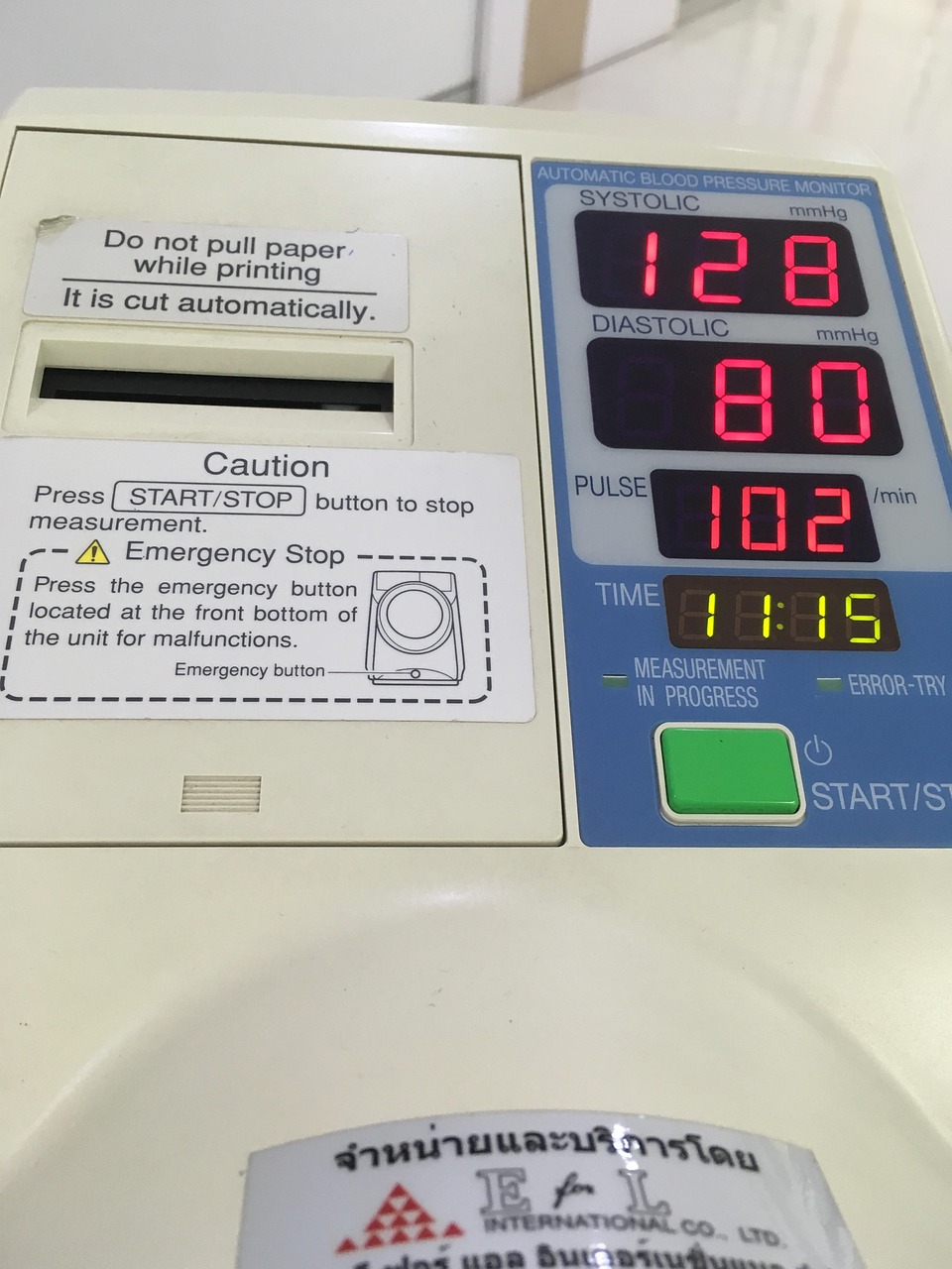 彩电高电压问题解析,B电压异常影响及解决方案探讨